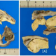 The teratoma contained bits of hair, skull, and surprisingly well-formed brain matter. (Image: Masayuki Shintaku et. al., 2017)